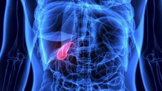 gallbladder removal surgery Gallmet capseules gallbladder removal surgery Gallmet capseules