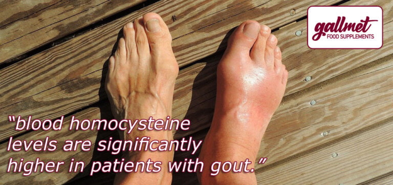 but blood homocysteine levels are significantly higher in gout patients