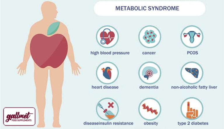 Association between metabolic syndrome and homocysteine levels